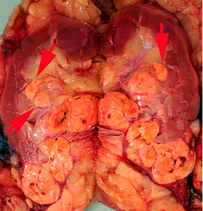 Figure 1B