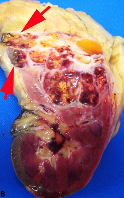 Figure 3B