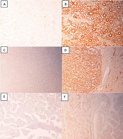 Figure1