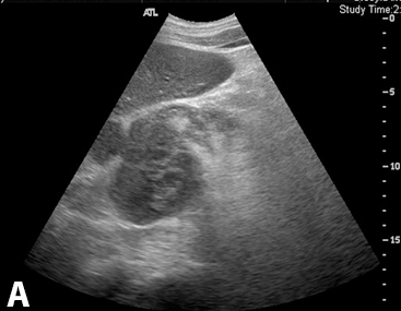 Figure 1 A Figure 1 A