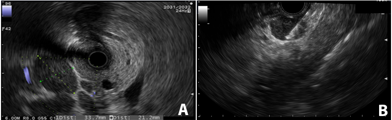 Figure 3 A B Figure 3 A B